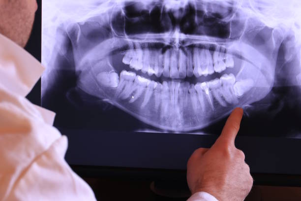 Best Emergency Dental Care for Broken or Chipped Teeth in Seagraves, TX