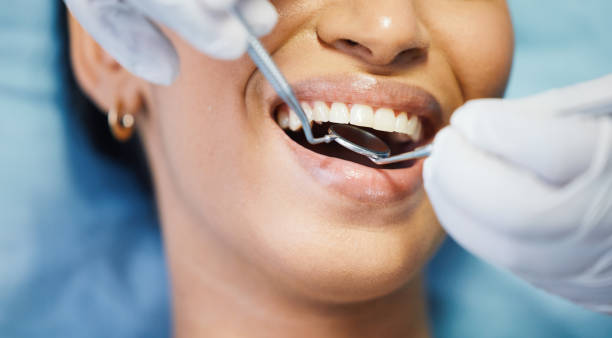 Best Emergency Dental Care for Broken or Chipped Teeth in Seagraves, TX